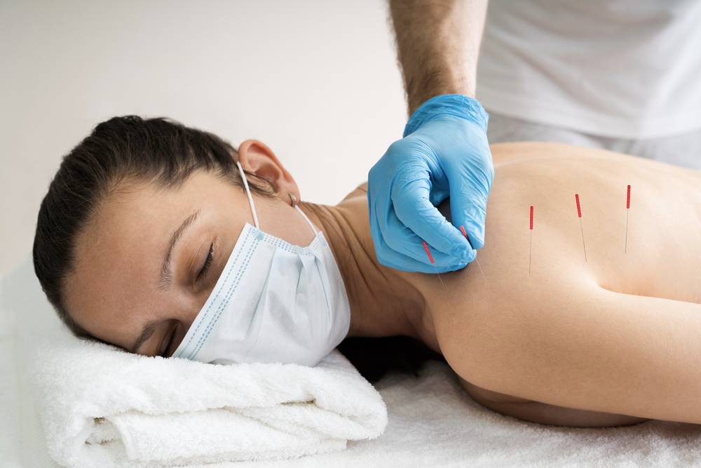 WHAT IS DRY NEEDLING?
